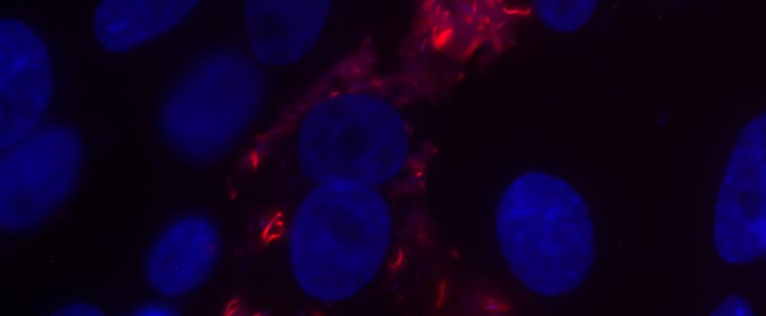 Fluorescent microscopy of intracellular bacteria (red) within the host cell (blue nucleus).