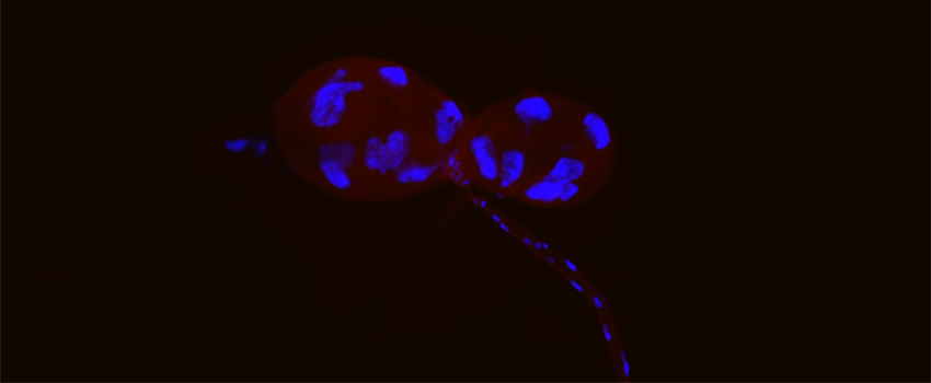 Dissected cat flea salivary glands. Specimen stained blue (Nuclei) and red (flea tissue). Visualized using fluorescence microscopy.